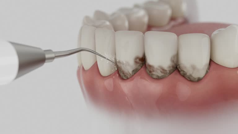 Reliable Dental contractor in Chesterfield, IN by Dentist Open Now